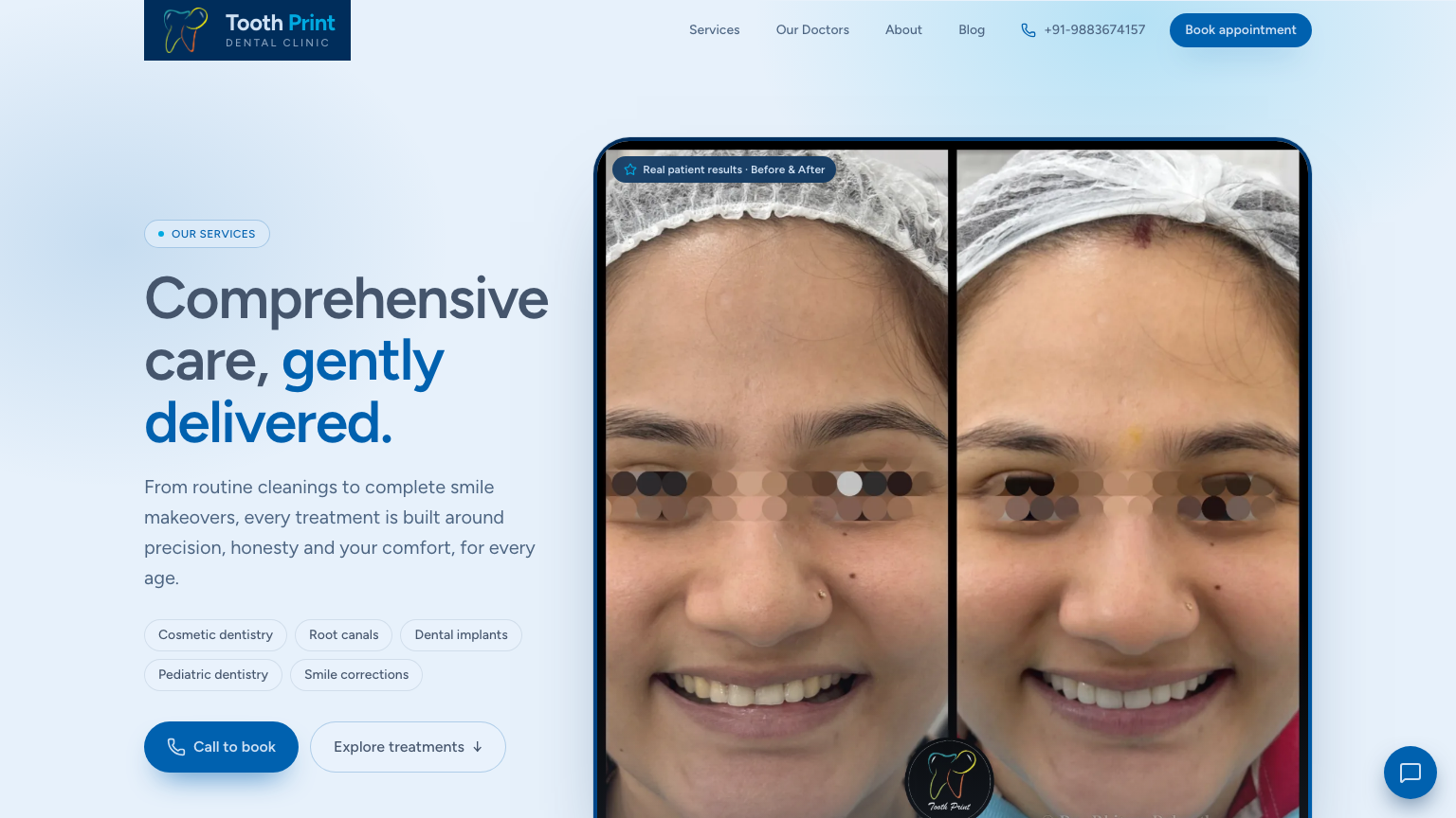 Tooth Print treatments — before-and-after outcomes presented without pressure